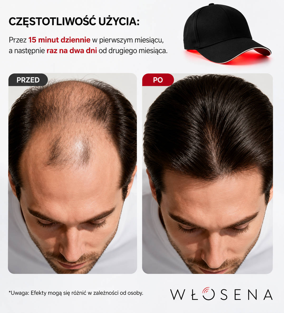 WŁOSENA® Czapka Terapii