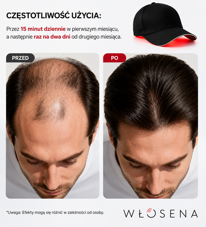 WŁOSENA® Czapka Terapii